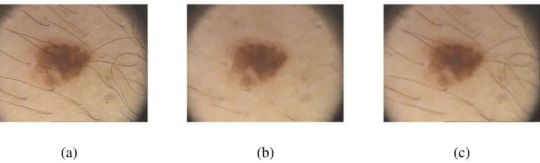 Figure 2.1: Image after applying median and gaussian filter: a) Original Image, (b) median filter and c) gaussian filter