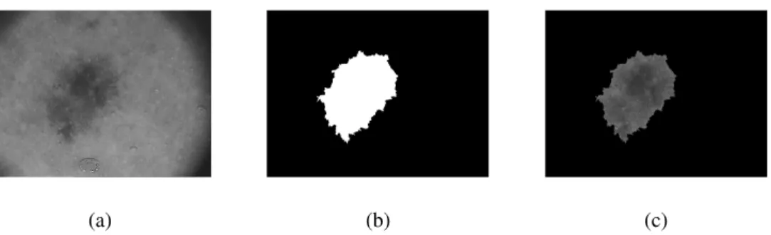 Figure 3.4: Segmentation of a pigmented skin lesion: a) Original RGB image; b) Binary mask; c) Result of the masking procedure