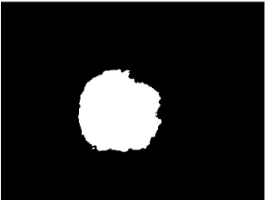 Figure 4.1: Binary image of a malignant lesion segmentation