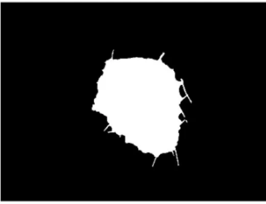 Figure 4.2: Binary image of a benign lesion segmentation with visible influence of hairs
