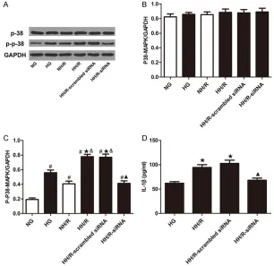 Figure 7. Effect of TXNIP interference on HH/R-induced activition of p38-MAPK. Expression of p38-MAPK (A, B) and p-p38-MAPK (A, C) were analyzed by Western blot