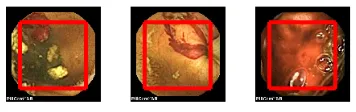 Figure 1. Bleeding and non-bleeding WCE images. 