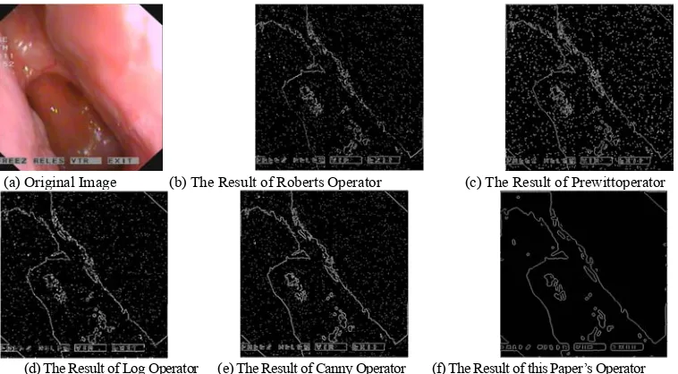 Figure 4. Oral Image Added Noise Processing Result. 