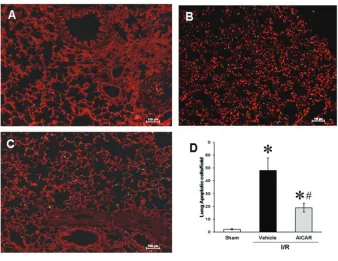 Figure 9. Apoptosis in the lung after intestinal I/R. Representative TUNEL staining of lung (A)sham, (B) vehicle, (C) AICAR-treated mice at 4 h after intestinal I/R