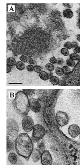FIG. 9. Immunoﬂuorescence staining of Gag proteins expressedwithin transfected COS-7 cells