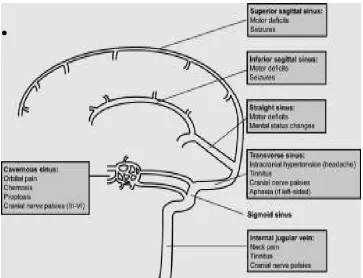 Figure 11:  sinuses and their clinical features 