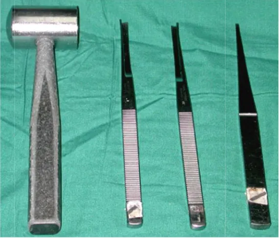Figure 4-Length 10mm- diameters from left to right-1.3mm, 1.4mm, 1.5mm, 1.6mmFigure 4-Length 10mm- diameters from left to right-1.3mm, 1.4mm, 1.5mm, 1.6mmFigure 4-Length 10mm- diameters from left to right-1.3mm, 1.4mm, 1.5mm, 1.6mm