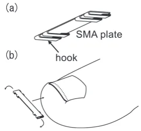 Fig. 1　Medical clip for relieving ingrown toenails made with a Cu-Al-Mn SMA (a), and its mounting method (b)13).