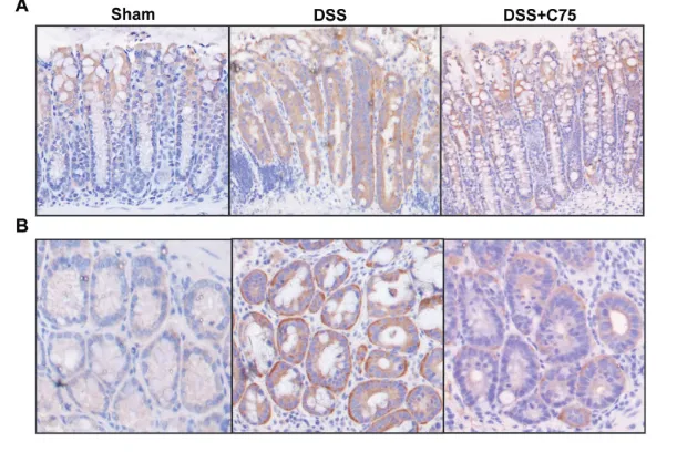 Figure 4. Effect of C75 treatment onchemokine expression and MPO activity inDSS colitis