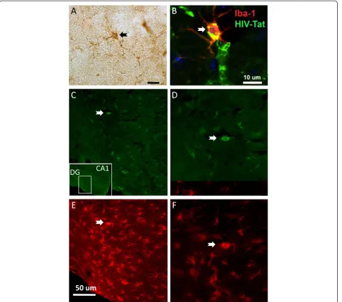 Figure 1 Expression of HIV-1 products in HIV-1 Tg rats. A) HIV protein Tat was detected by immunohistochemistry with peroxydasedetection in the hippocampus in cells with microglia morphology (arrow) and B) by immunofluorescence with double labeling of HIV-