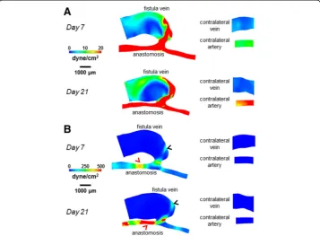 Fig. 6 Spatial WSSg color maps for the AVF and contralateral non-surgery controls. The color bars areadjusted to emphasize the WSSg distributions in the vein (a) and artery (b)