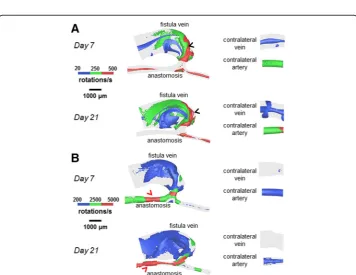 Fig. 7 OSI color maps for the AVF and contralateral non-surgery controls. The color bars are adjusted toemphasize the OSI distributions in the vein (a) and artery (b)