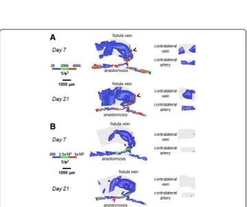 Fig. 9 Helicity isosurfaces for the AVF and contralateral non-surgery controls. The colors are adjusted toemphasize the helicity distributions in the vein (a) and artery (b)