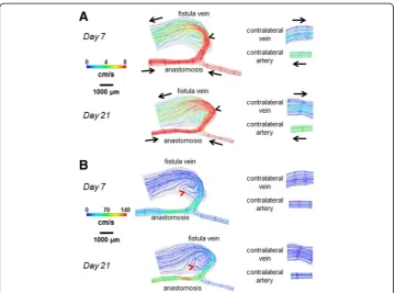Fig. 4 Velocity streamlines for the AVF and contralateral non-surgery controls. The color bars are adjusted tovein, with velocity of this flow jet increasing from day 7 to day 21.emphasize the velocity distributions in the vein (a) and artery (b)