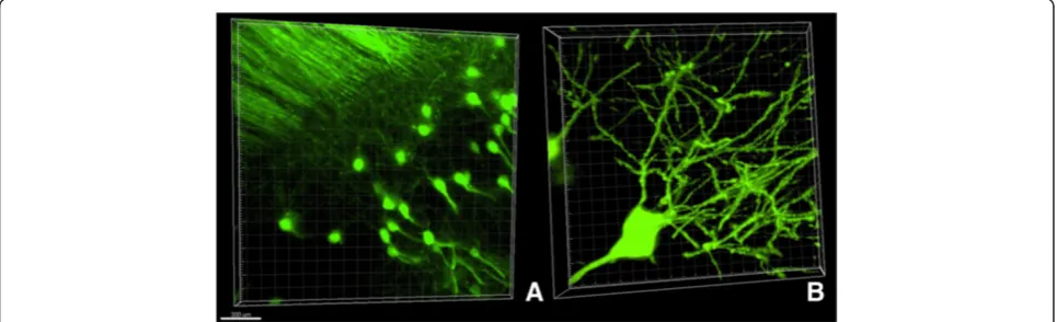 Figure 2 Confocal images of hippocampal neurons from line M Thy1-GFP mouse. (A) Neuronal structures of hippocampus, 20x objective.Scale bar is 300 microns