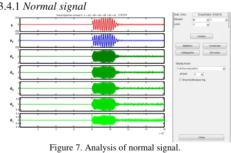 Figure 7. Analysis of normal signal. 