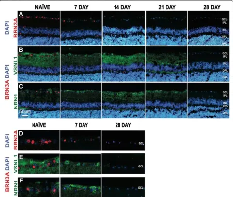 Figure 5 Expression of Brn3a, Vsnl1 and Nrn1 in the retina following ONC. Progressive loss of RGCs observed with Brn3a and a biphasicpattern of expression observed for Vsnl1 and Nrn1