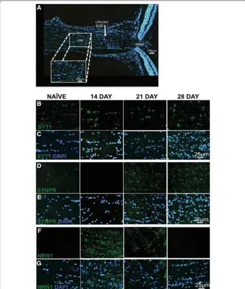 Figure 6 Expression of Syt1, Synpr and Nrn1 in the optic nerve following ONC. Differential protein expression of Syt1, Synpr and Nrn1observed within cytoplasmic region of ON cells following trauma