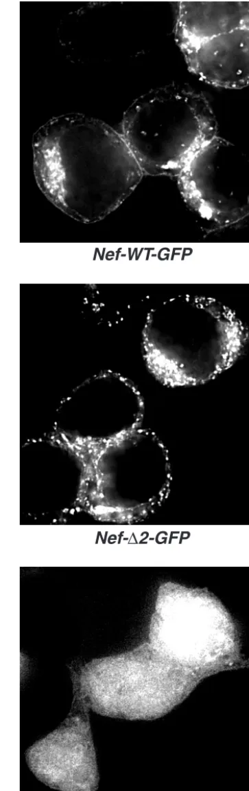 FIG. 4. Localization of Nef-GFP fusion proteins. 293T cells trans-fected with Nef-GFP expression vectors were visualized by ﬂuores-