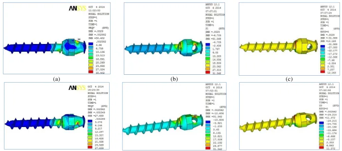 Fig-19: Stress plot showing (a) Vonmises (b) Maximum Principal (c) Minimum Principal stress between  Group-I (Top Panel) and Group-II (Lower Panel) in mini screw with Angulation of Force as variable 