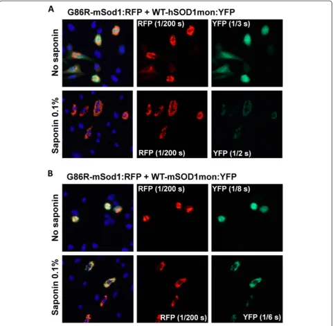 Figure 9 Co-transfection of G86R-mSod1:RFP with WT-hSOD1mon and WT-mSod1mon fused to YFP