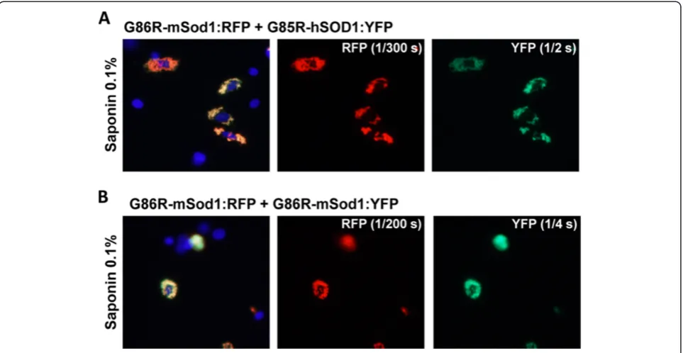 Figure 5 Co-transfection of mutant mSod1 fused to RFP with G85R-hSOD1:YFP. The indicated fused constructs were expressed in CHO cellsas explained in previous figure legends and Methods
