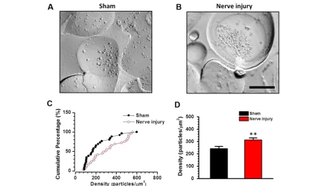 Figure 1 Postsynaptic accumulation of GluA1 in the ACC after nerve injury. (A-B) SDS-digested freeze fracture replica labeling EM samplesshowing that increased GluA1 particles in the synaptic region on ACC layer V neurons in mice with nerve injury compared