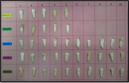 Fig no-2: Armamentarium used in the study. 