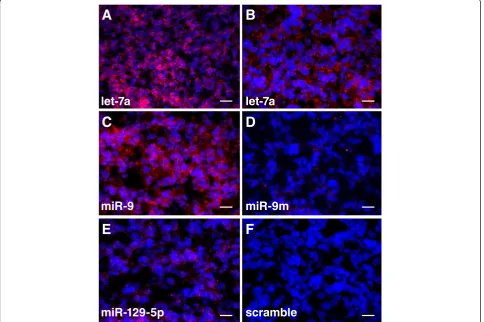 Figure 3 The downregulatory effects of let-7a, miR-9, and miR-129-5p are mediated via specific sequences in the human FOXP2 3′ UTR.(A) miR-9, miR-19b, miR-140-5p, miR-200a, let-7a, miR-129-5p, miR-582-5p, and miR-892a significantly repressed luciferase act