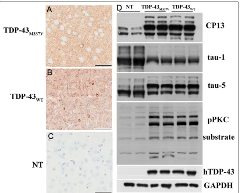 Figure 8 Tau pathology in TDP-43M337V mice. Immunohistochemistry of the cortices of (A) TDP-43M337V and (B) TDP-43WT mice showedelevated levels of phosphorylated tau (CP13) in both TDP-43M337V and TDP-43WT mice compared to (C) NT mice