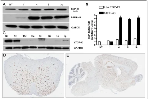 Figure 1 TDP-43 expression in TDP-43 M337V micespinal cord (SC), thigh muscle (TM), heart (He), stomach (St), kidney (Ki), live (Li) and spleen (Sp) probed with an antibody against hTDP-43reveals high expression in the brain and spinal cord (line 4)