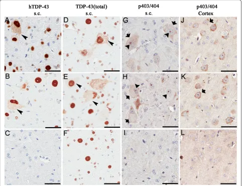 Table 1 Regional distribution of pathologies in TDP-43M337V mice