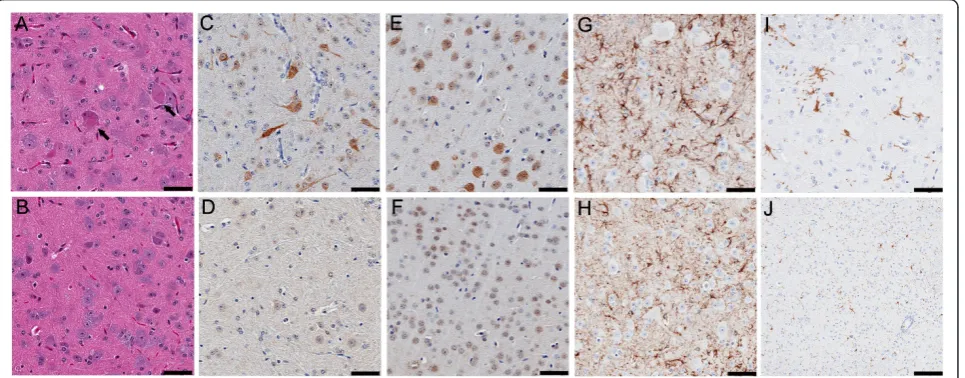 Figure 5 Neuropathology in TDP-43microglia, respectively, were observed in TDP-43nucleus of neurons in the (C) spinal cord of TDP-43M337V mice