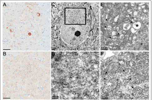Figure 6 Abnormal mitochondrial aggregations in TDP-43appear smaller in size compared with those of (F) NT mice