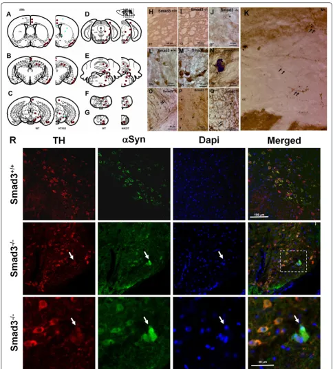 Figure 9 Aggregation ofneurons. The aggregates observed in Smad3 deficiency are double-labelled for both molecules (arrow)