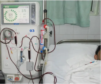 Figure 5: Patient undergoing dialysis with Non Tunnelled Jugular catheter. 