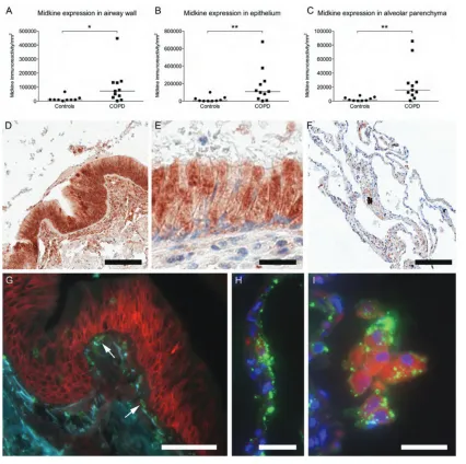 Figure 1. MK as detected by immunofluorescence in lung tissue from COPD. The immunoreactivity of MK expression, expressed as positivepixels per mm2, in the small airway wall (A), small airway epithelium (B) and alveolar parenchyma (C)