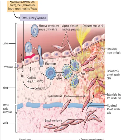 Fig 3: Pathogenesis off atherosclerosis 
