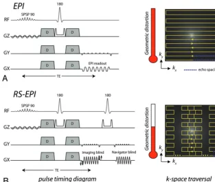Fig 1. Pulse-timing diagram and k-space traversal of the (A) EPI and (B) RS-EPI trajectories