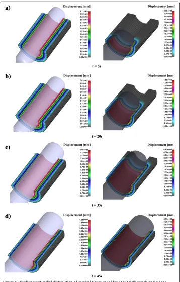 Figure 5 Displacement radial distribution of cervical tissue canal for CCBD (left panel) and Hegardilator (right panel) in time; a) Displacement after 5 sec; b) Displacement after 20 sec; c) Displacementafter 35 sec; d) Displacement after 45 sec.