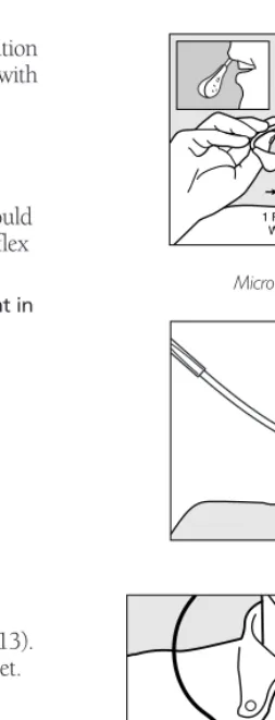 Figure 11Microphone Positioning