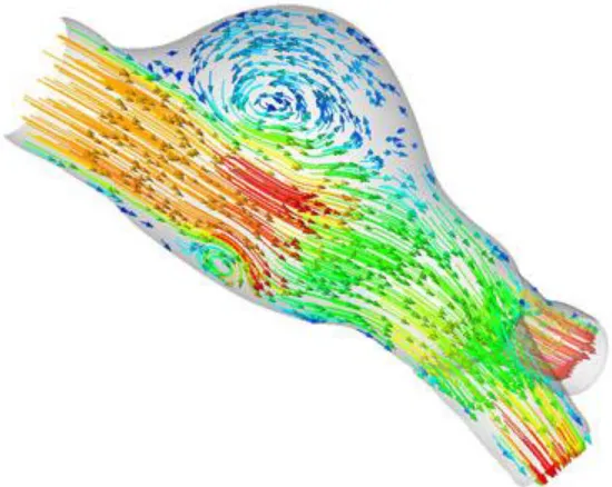 Figure 1.10 Compuation model of an arterial bifurcation  