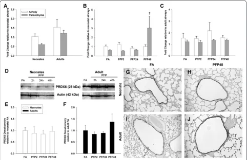 Figure 8 PRDX6 mRNA and protein expression. RT-PCR: (A) Basal PRDX6 mRNA was similarly expressed between ages andtrended upwards at PFP48.compartment differences were observed post exposure