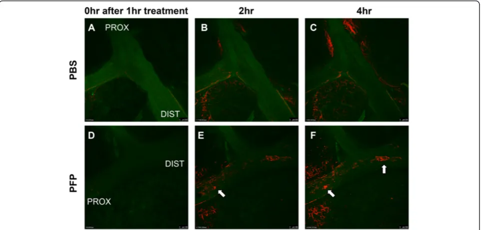 Figure 2 Ex vivo oxidative stress detection. Rat right cranial lobes were dissected to expose the main axial airway and airways were treatedwith either PFP or PBS