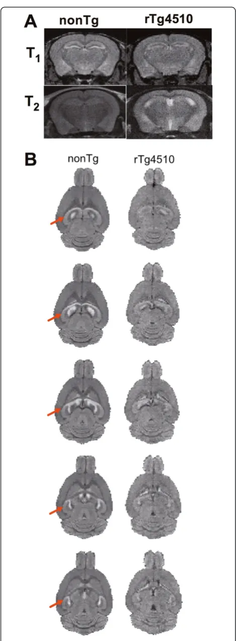 Figure 2 Functional mapping of basal neural activity in controlnonTg and mutant tau expressing rTg4510 mice using MEMRI.A) Coronal view of dorsal hippocampal signal intensity in nonTg andrTg4510 mice