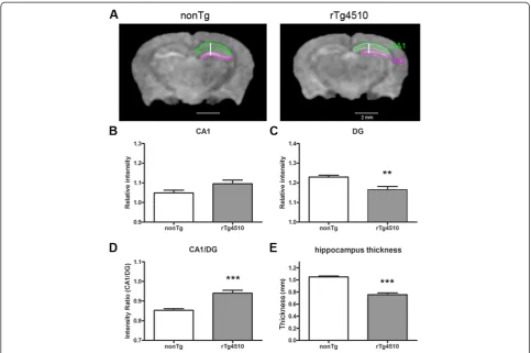 Figure 4 Manganese enhanced intensity and thickness of hippocampus. A) Representative coronal sections of non Tg and rtg4510 mousebrains
