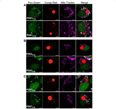 Figure 6 Nucleoid content in cells containing CLB in PDOrig and PDCLB cell lines. (A,B,C) Representative images of cells containing CLB inPDOrig and PDCLB pairs