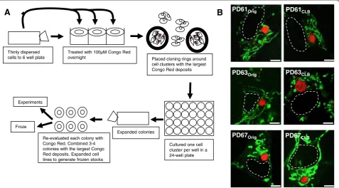 Figure 1 PDCLB cell lines were created from PDOrig cell lines. (A) PDCLB lines were created by selecting for cells containing large, circular,Congo red positive inclusions (CLB) as shown in this diagram