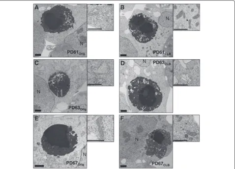 Figure 2 Electron micrographs of CLB and mitochondria in PDOrig and PDCLB cybrid lines