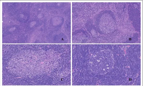 Fig. 5 Immunohistochemical features of the lymphoid follicles. a The whole areas of lymphoid follicles were positive for CD20 (10x)